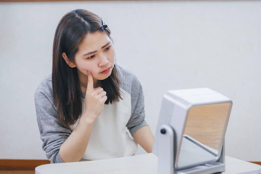 ニキビ跡の種類と特徴