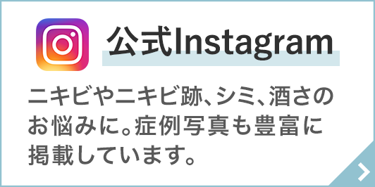 Instagramリンク