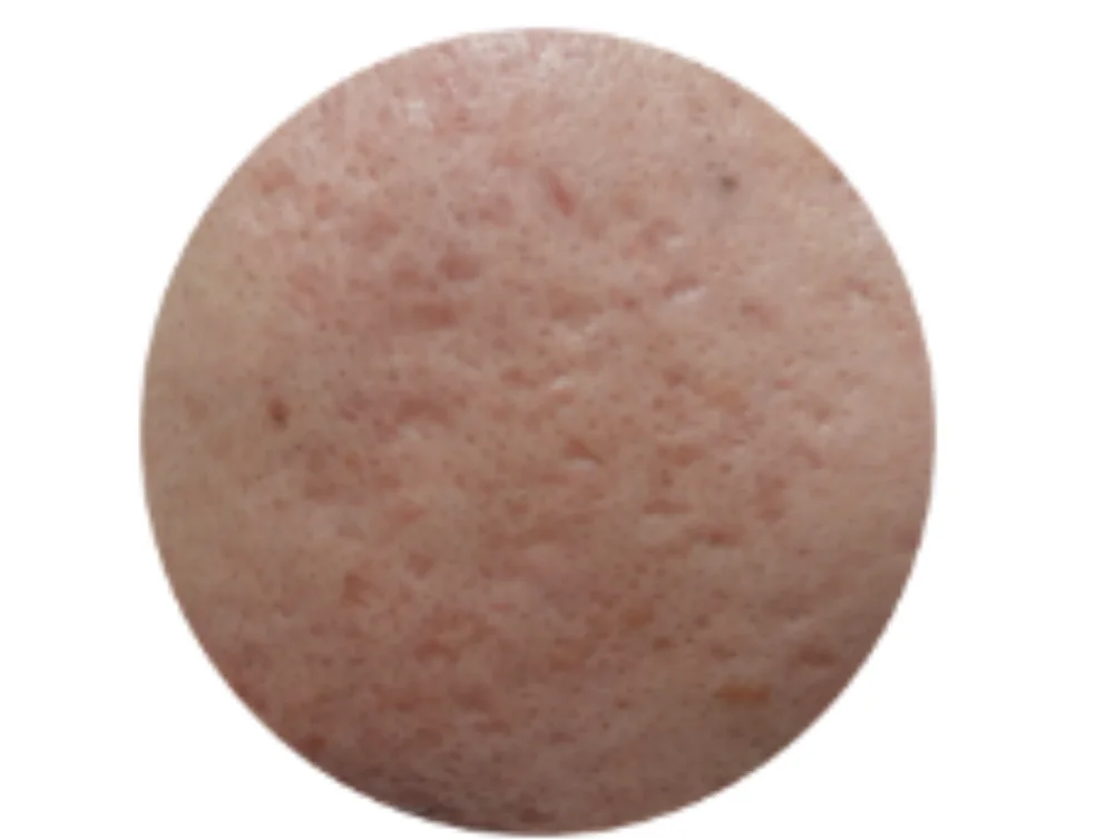 ボックスカー型